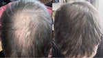 Antes y después con RedLume
